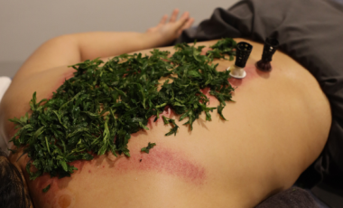 NGẢI CỨU TRỊ LIỆU
