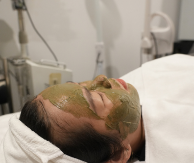 Những Sai Lầm Sau Khi Điều Trị Mụn Trứng Cá Trong Giai Đoạn Dậy Thì.